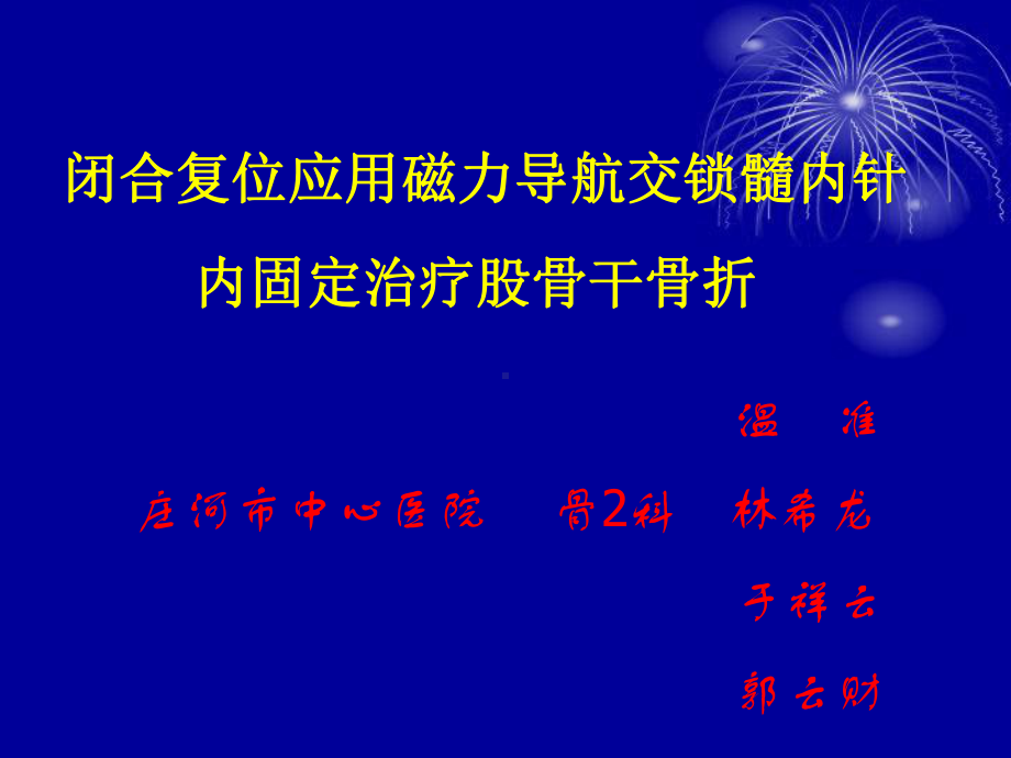 闭合复位应用磁力导航交锁髓内针内固定股骨干骨折课件.ppt_第1页