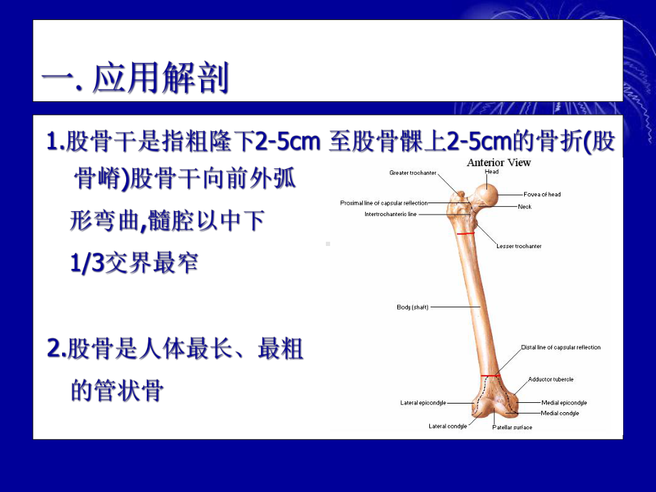 闭合复位应用磁力导航交锁髓内针内固定股骨干骨折课件.ppt_第3页