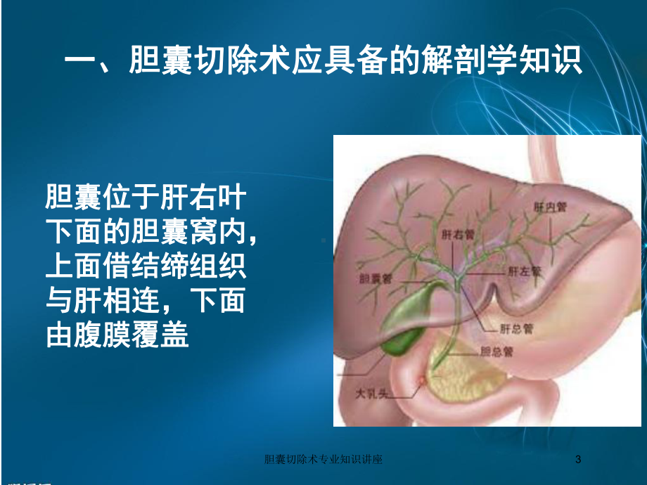 胆囊切除术专业知识讲座培训课件.ppt_第3页