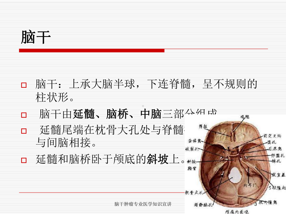 脑干肿瘤专业医学知识宣讲培训课件.ppt_第3页