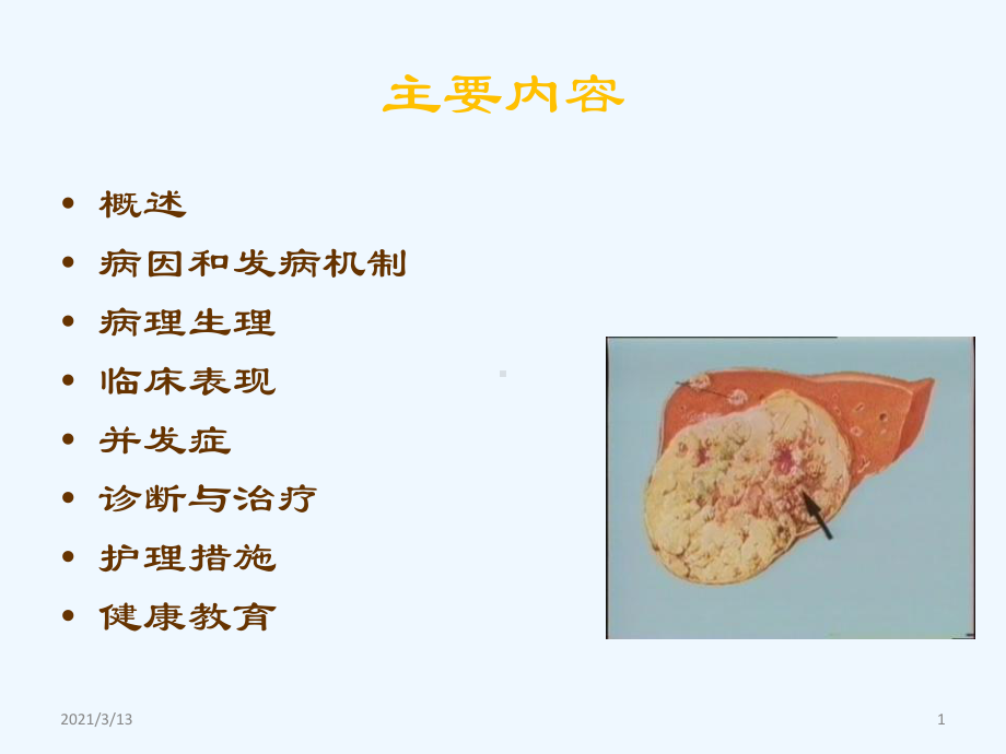 读书报告原发性肝癌课件.ppt_第1页