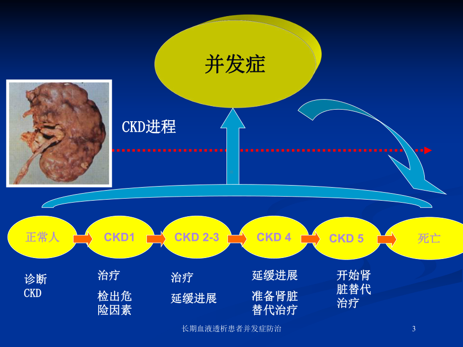 长期血液透析患者并发症防治培训课件.ppt_第3页