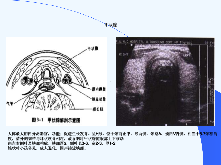 超声医学解剖课件.ppt_第3页