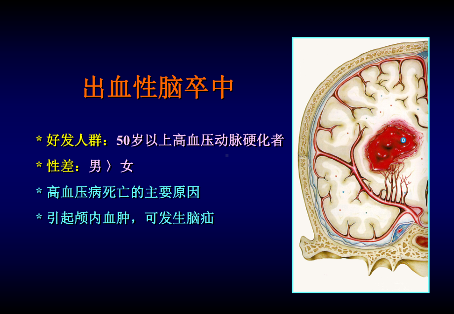 脑卒中的外科治疗课件.ppt_第2页