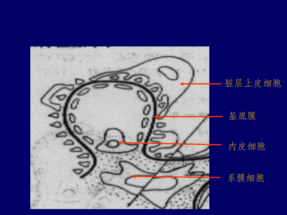 肾病综合征病理图片课件.ppt_第3页