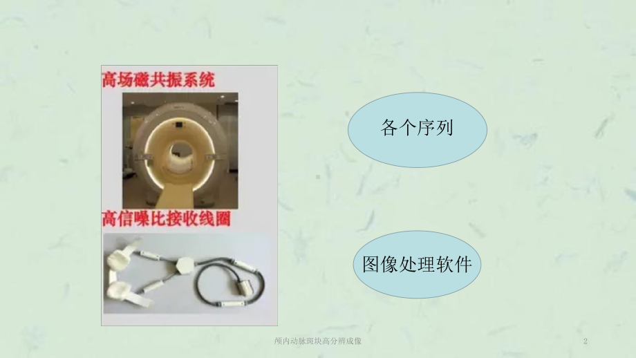 颅内动脉斑块高分辨成像课件.ppt_第2页