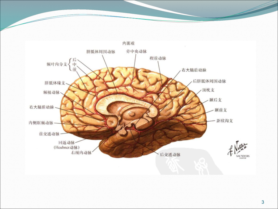 脑梗死责任血管分析优质课件.ppt_第3页