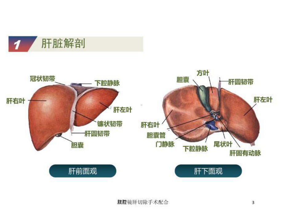 腹腔镜肝切除手术配合培训课件.ppt_第3页