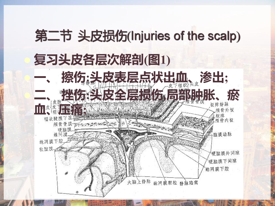 脑外科教学-颅脑损伤-课件.pptx_第2页