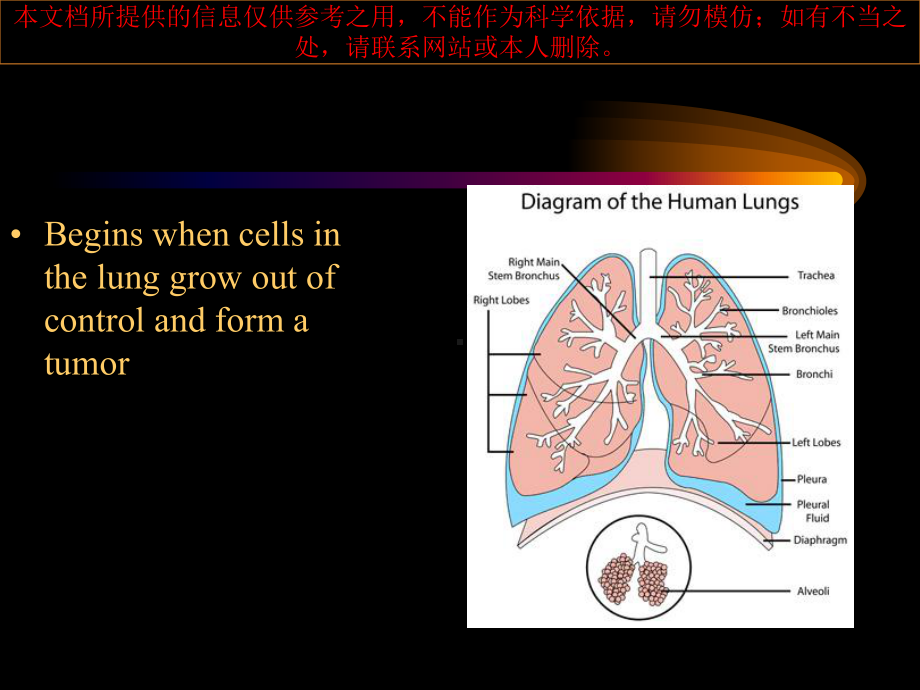 讲课肺癌英文培训课件.ppt_第1页