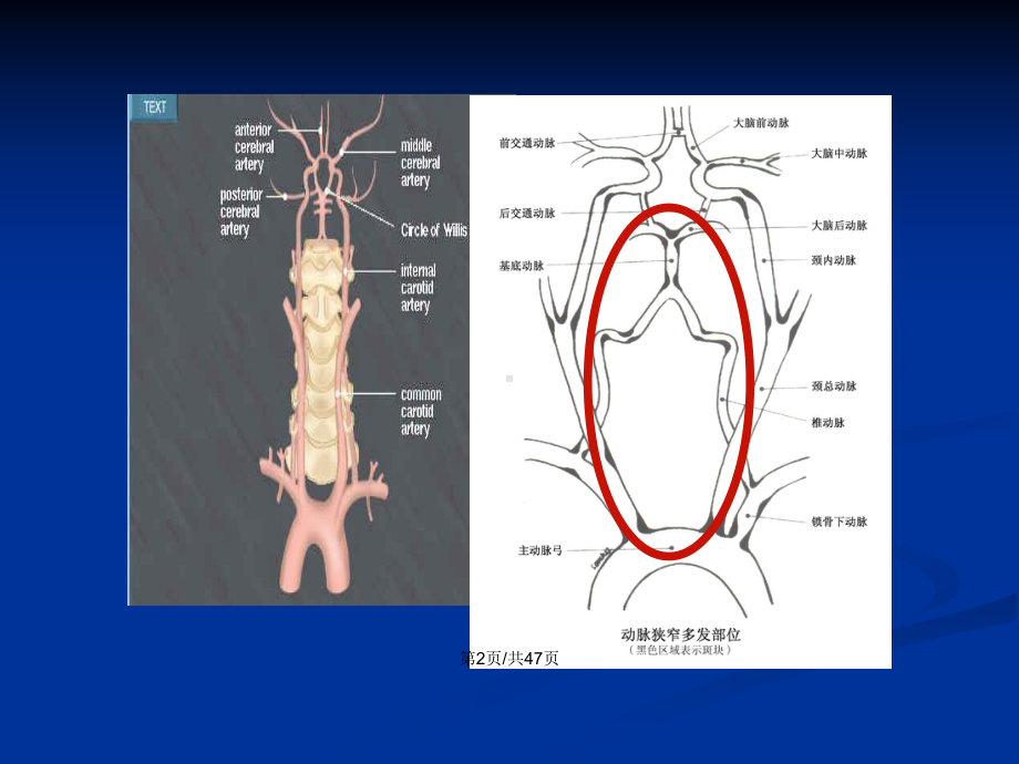 临床医学后循环缺血专家共识学习教案课件.pptx_第3页