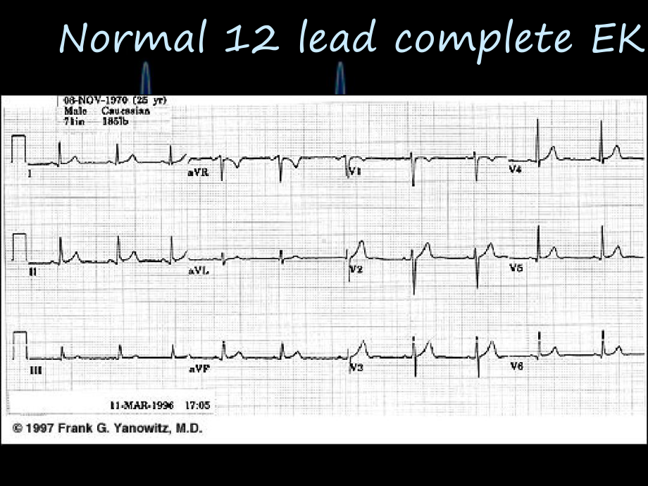 见习医师心电图教学基础课件.ppt_第2页