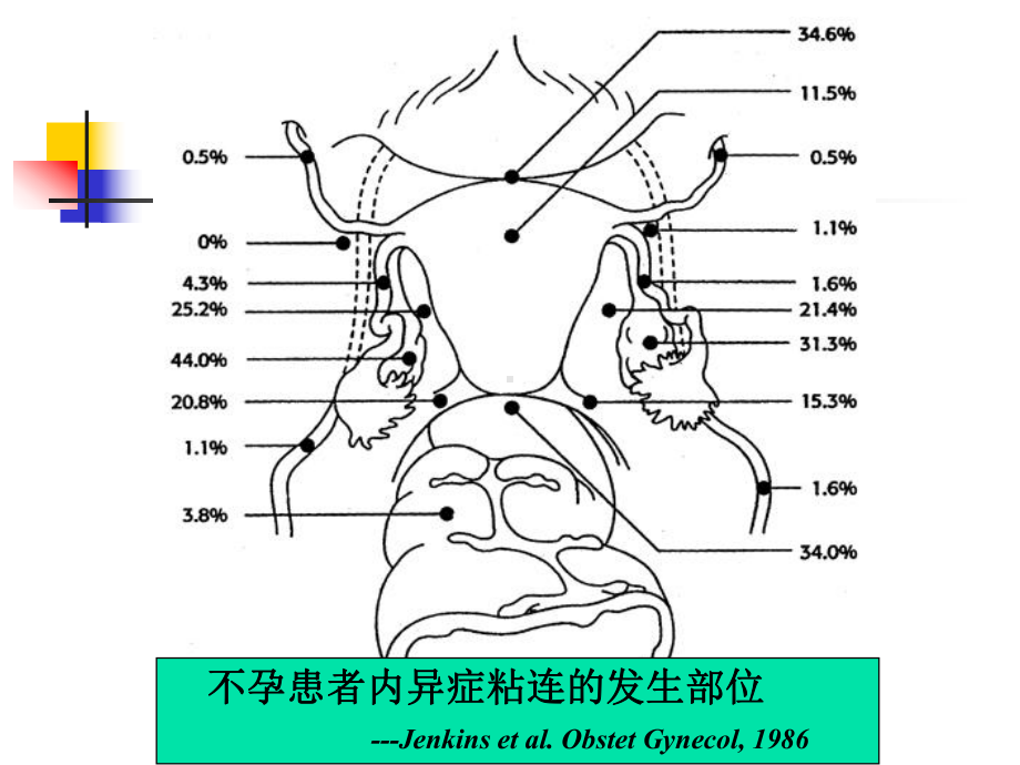 子宫内膜异位症与不育田秦杰课件.ppt_第3页