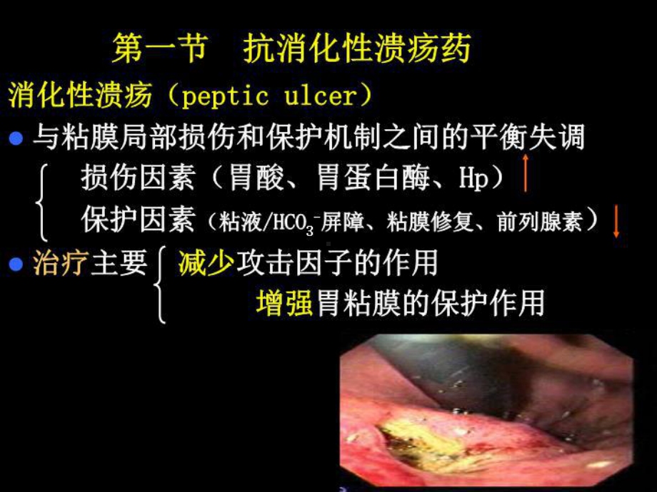 药理学-第2版32作用于消化系统药物-课件.ppt_第2页