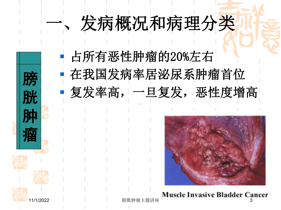 膀胱肿瘤主题讲座培训课件.ppt_第3页