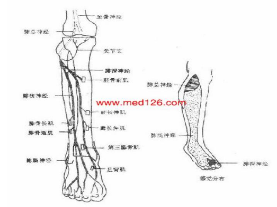 腓总神经受损和护理演示文稿课件.ppt_第3页