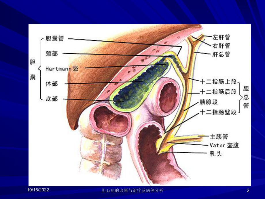 胆石症的诊断与治疗及病例分析培训课件.ppt_第2页