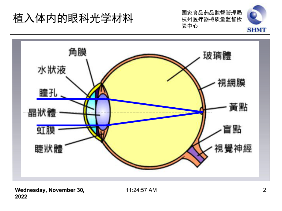 植入体内的眼科光学材料课件.ppt_第2页