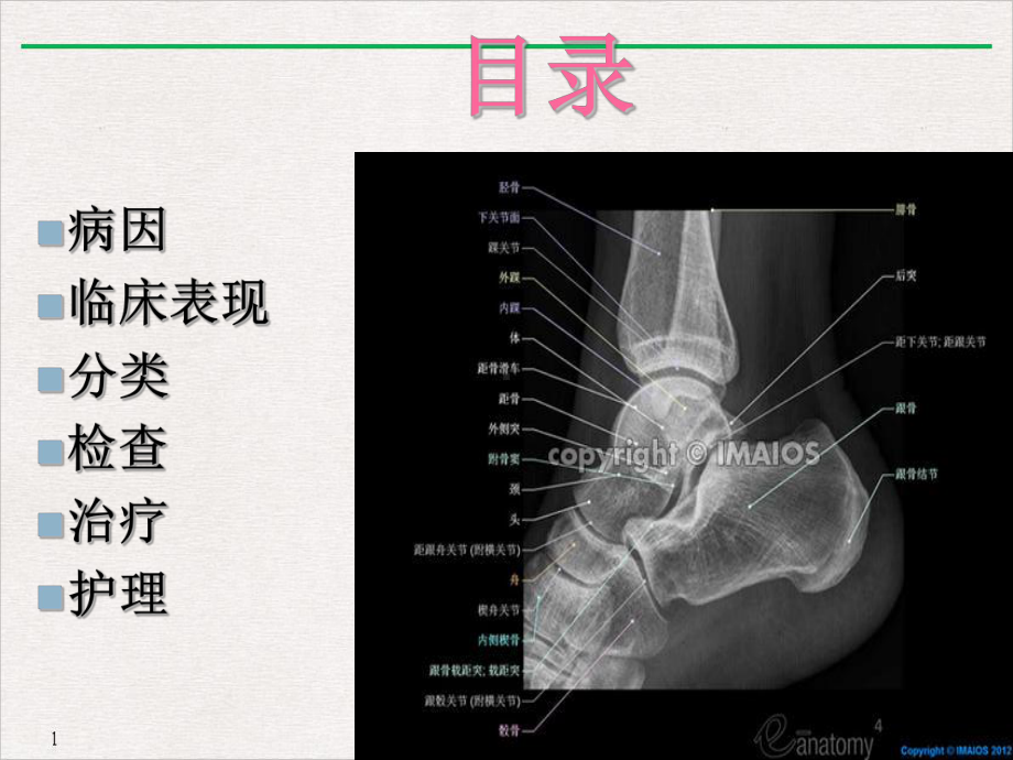 踝骨骨折演示文稿课件.pptx_第1页