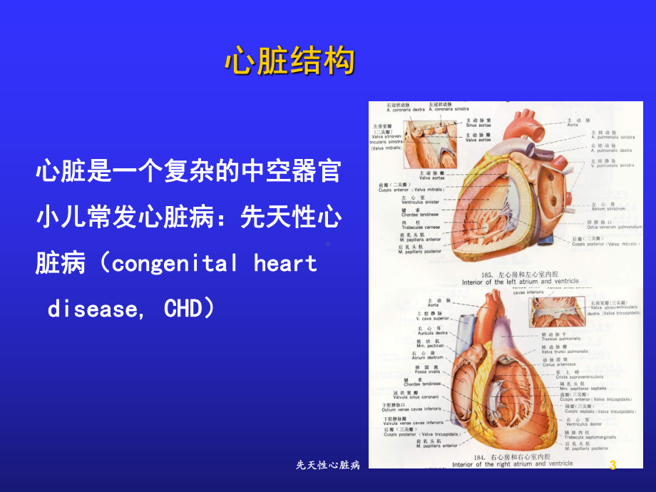 先天性心脏病培训课件2.ppt_第3页