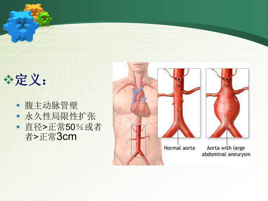 腹主动脉瘤的护理讲课课件.ppt_第3页