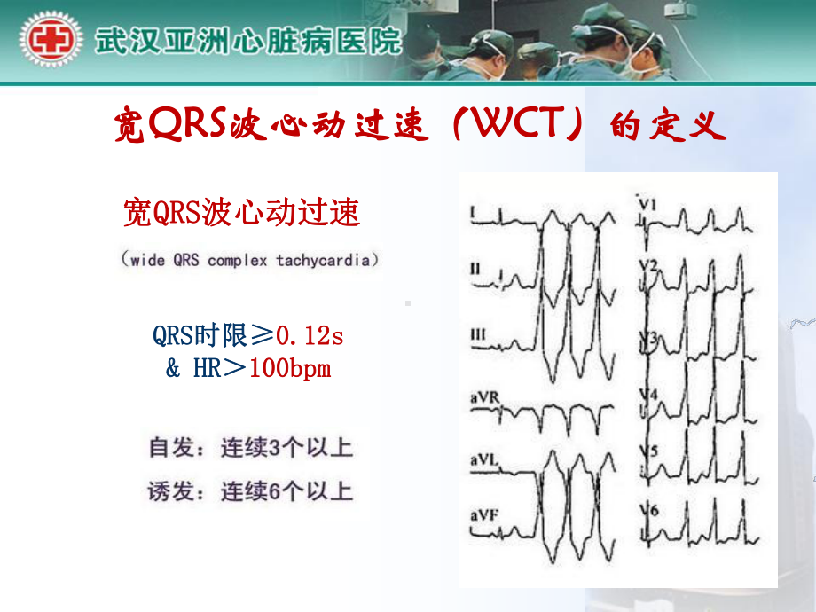 宽qrs波心动过速分类及心电图识别-课件.ppt_第2页