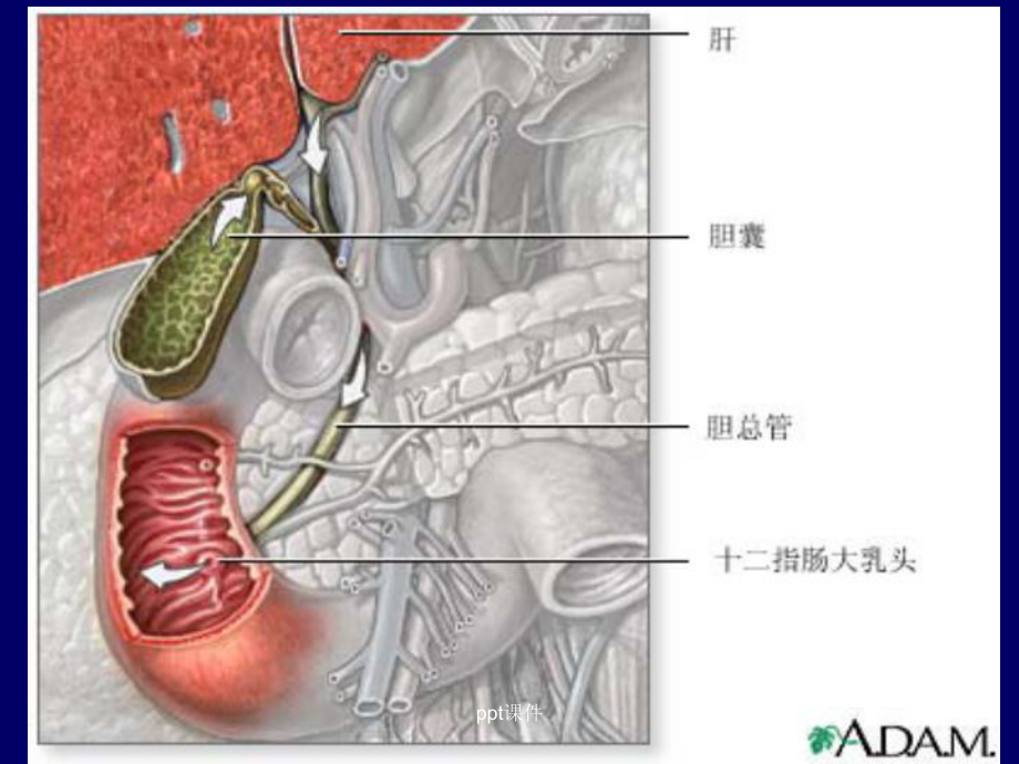 胆道休克-课件.ppt_第3页