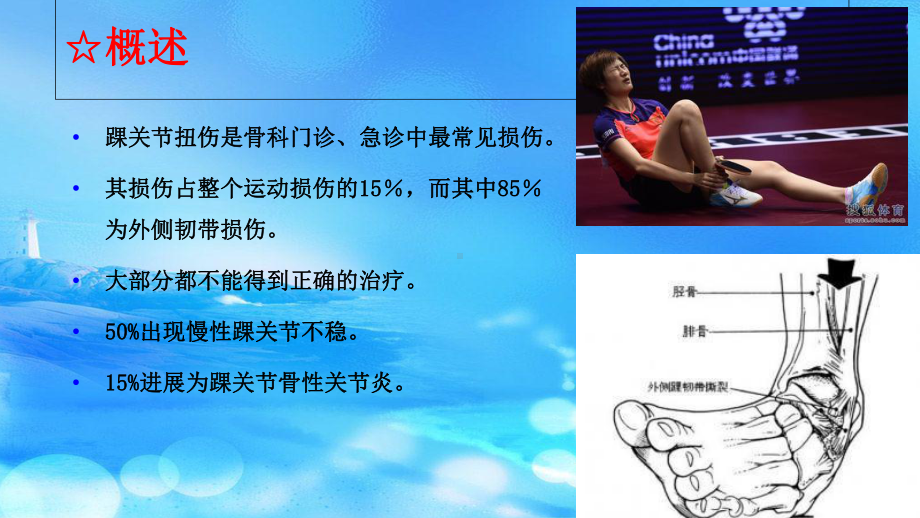 踝关节扭伤治疗及转归课件.ppt_第2页