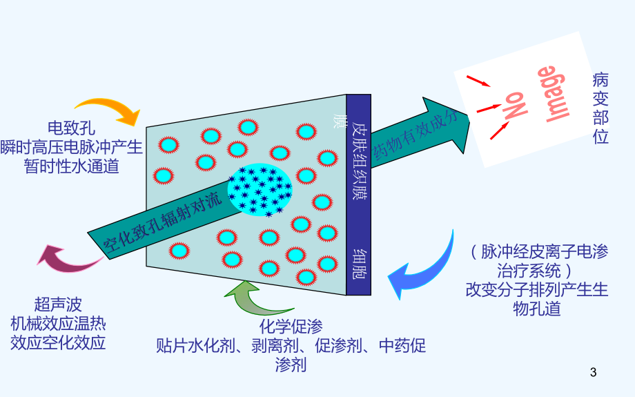 超声药物透入疗法对临床常见痛症治疗课件.ppt_第3页