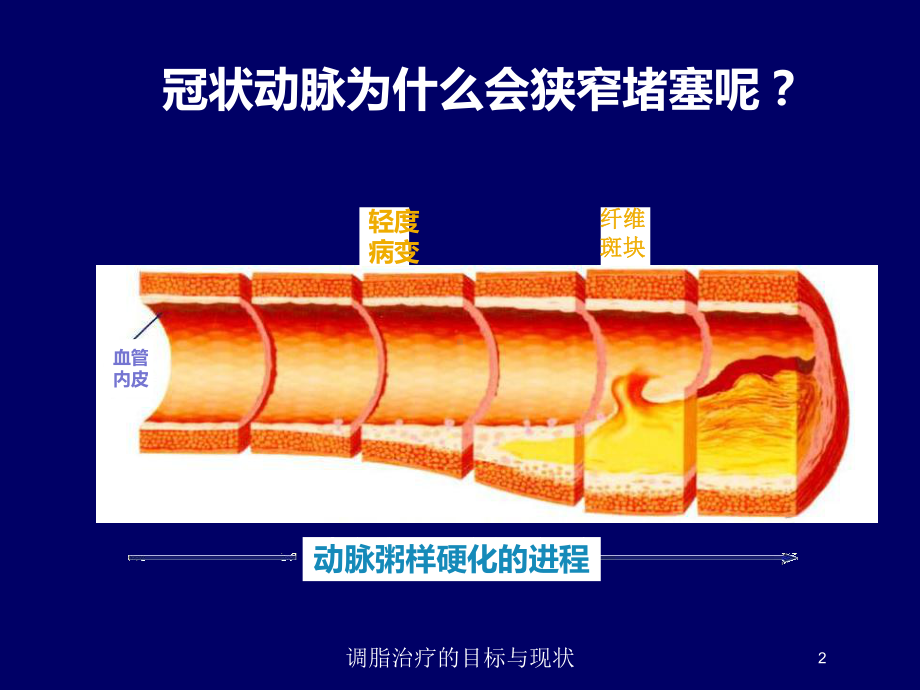 调脂治疗的目标与现状培训课件.ppt_第2页