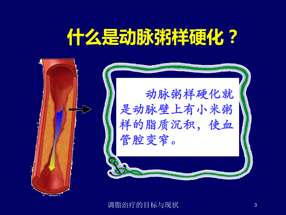 调脂治疗的目标与现状培训课件.ppt_第3页