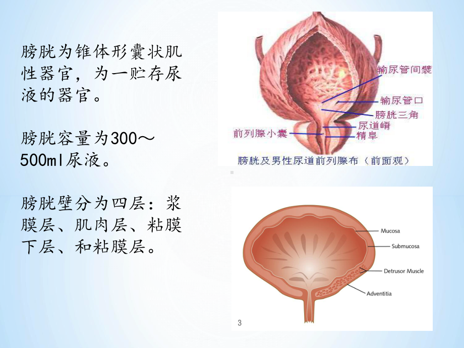 膀胱癌根治术患者的护理查房课件.ppt_第3页