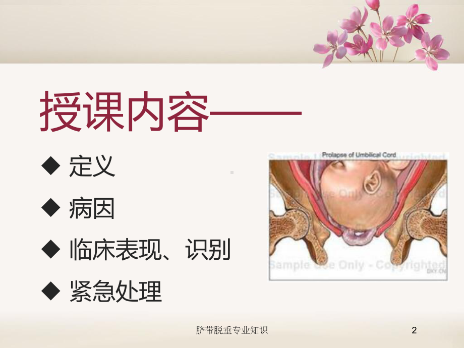 脐带脱垂专业知识培训课件.ppt_第2页