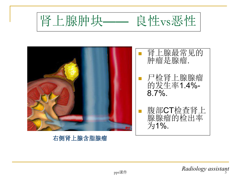 肾上腺占位的CT鉴别诊断-课件.ppt_第3页