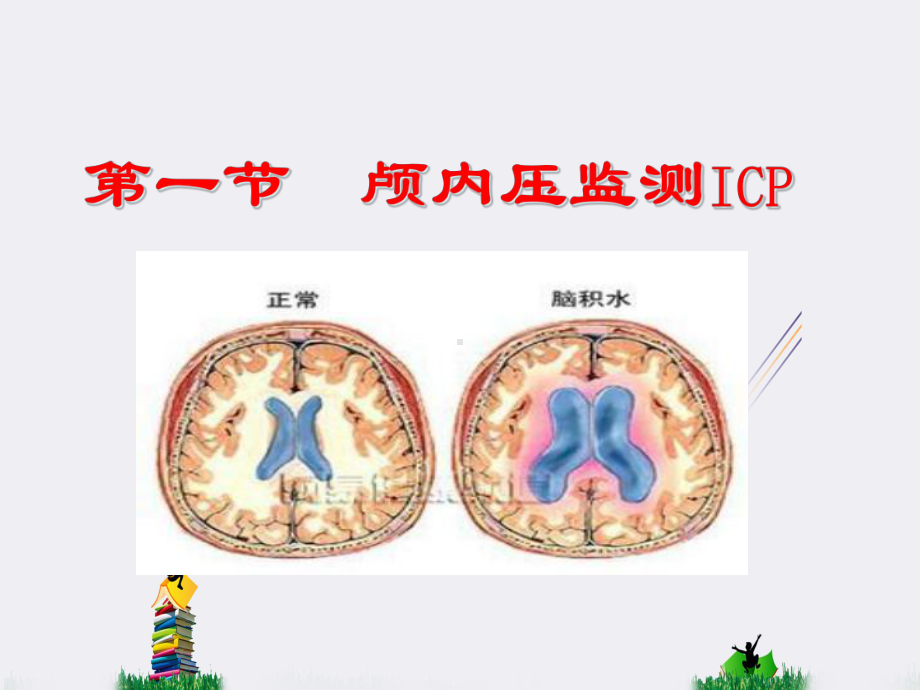 第九章脑功能监测CFMCerebralfunctionmonitoring课件.ppt--（课件中不含音视频）_第3页