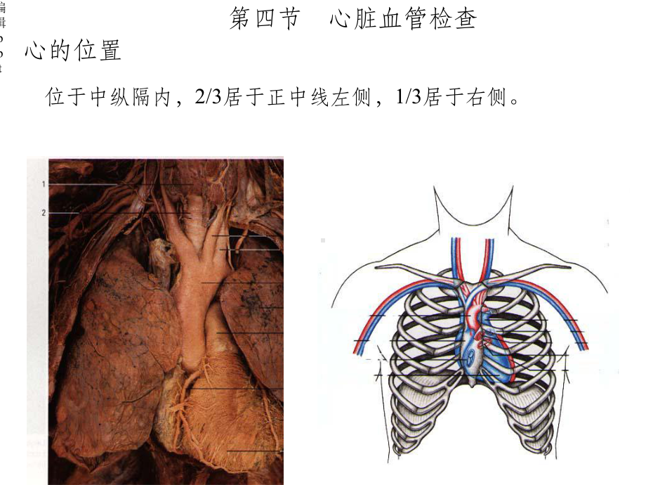 心脏体格检查课件.ppt_第3页