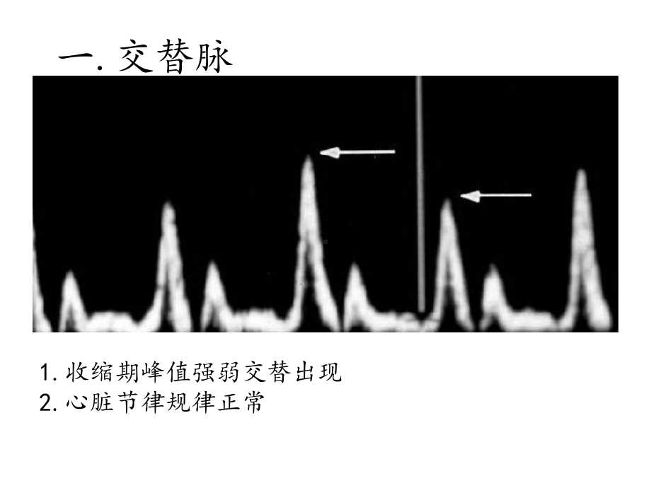 外周血管疾病的异常频谱课件.pptx_第2页