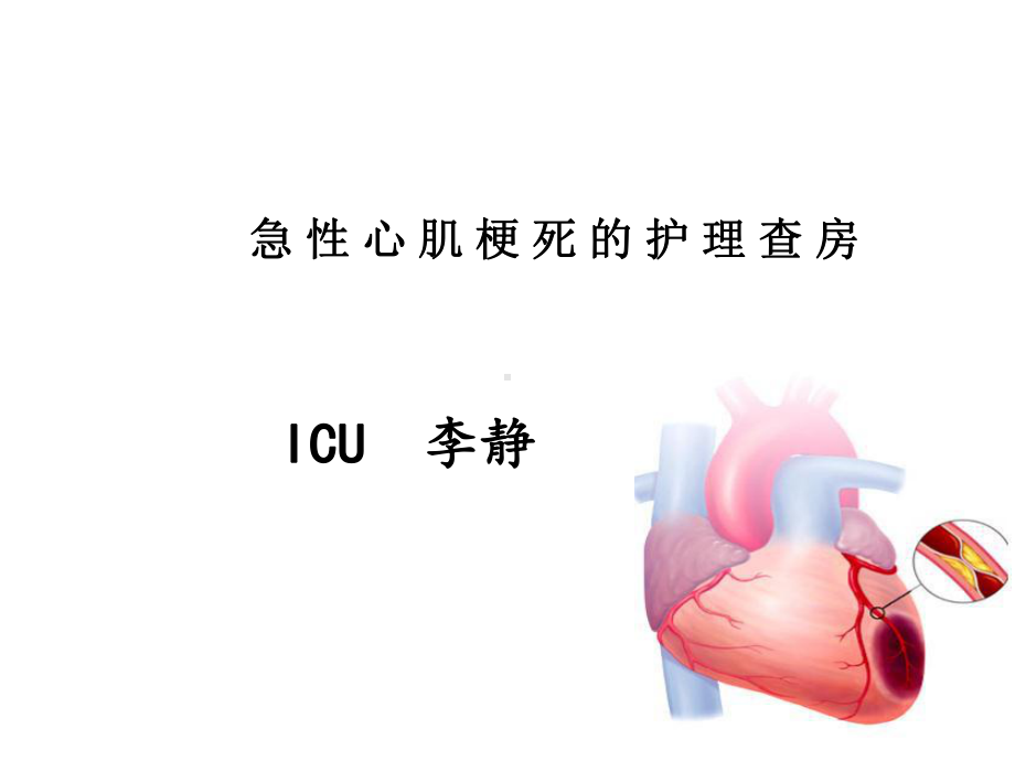 急性心肌梗死病人的护理查房课件.ppt_第1页