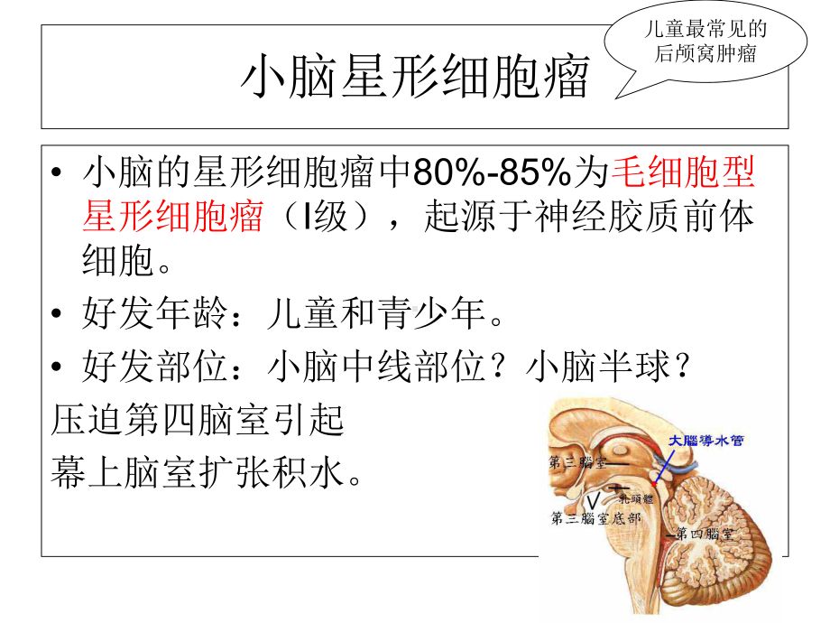 小脑肿瘤的影像诊断课件.ppt_第3页