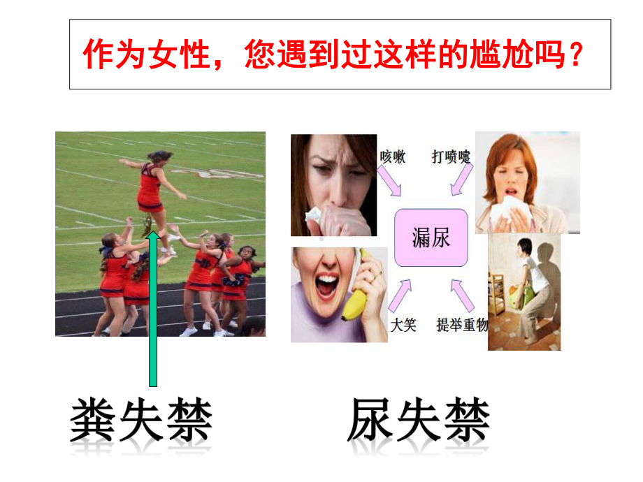 女性盆底功能障碍性疾病课件.ppt_第2页