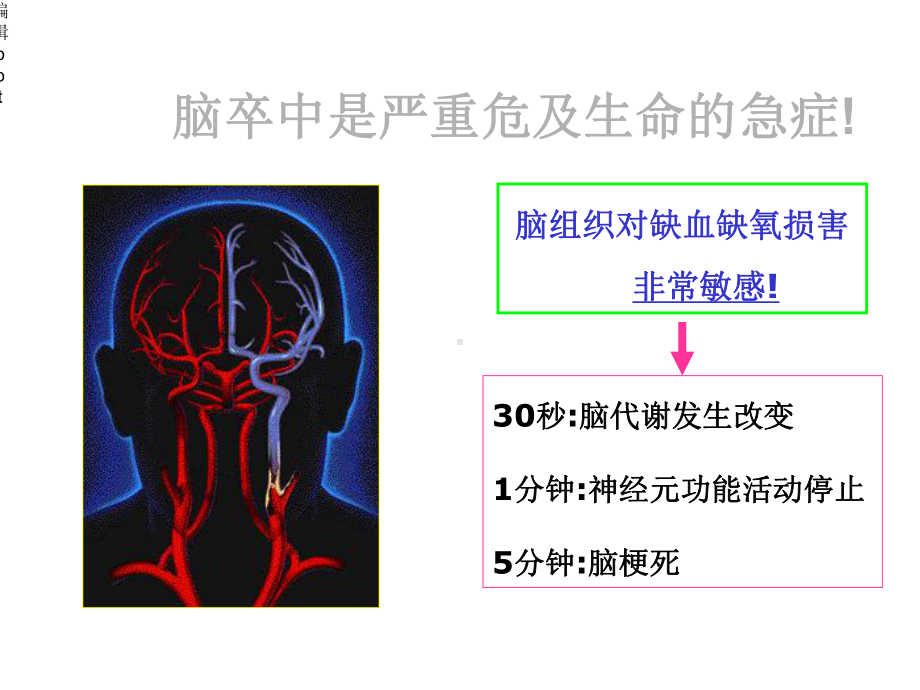 急性缺血性脑卒中静脉溶栓课件.ppt_第3页