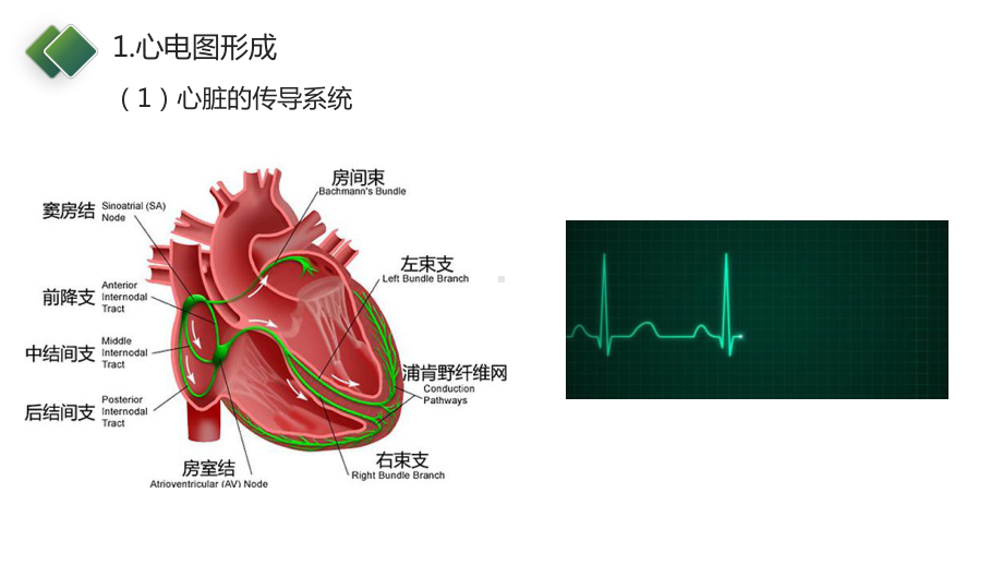 护理技能大赛—心电图判读课件.pptx_第3页