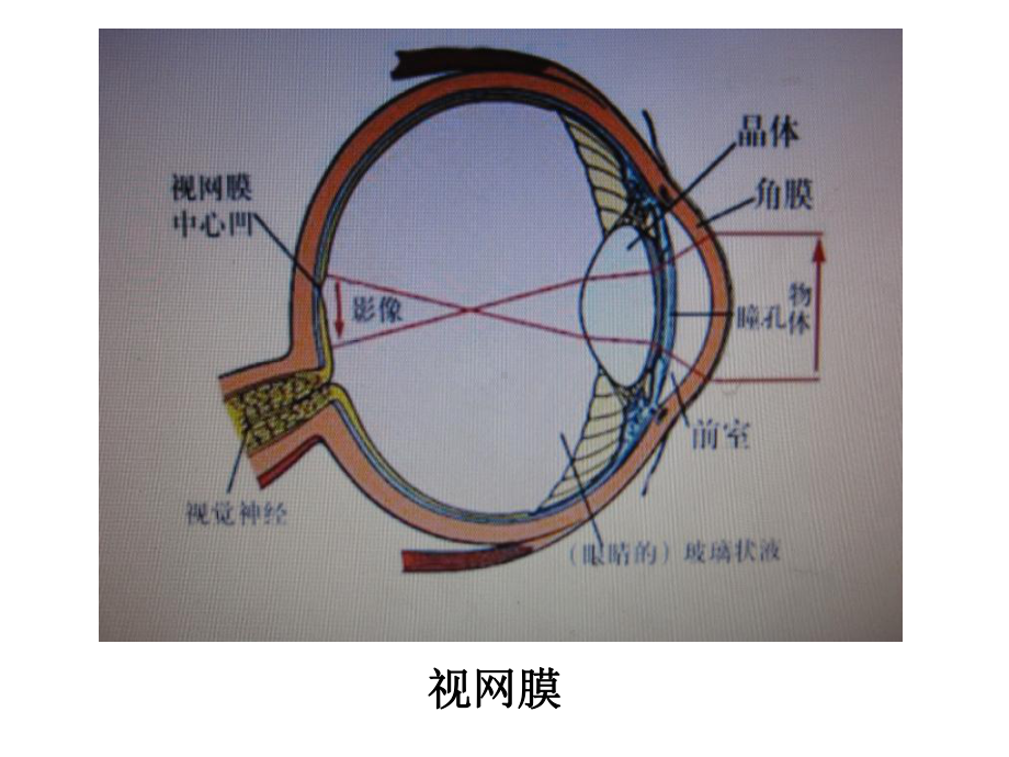 消渴目病中医护理方案十四病区-精选课件.ppt_第3页