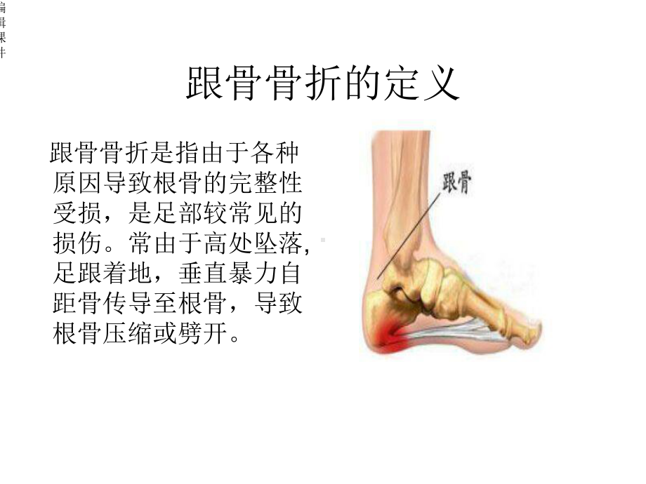 新建跟骨骨折的护理查房课件.ppt_第2页