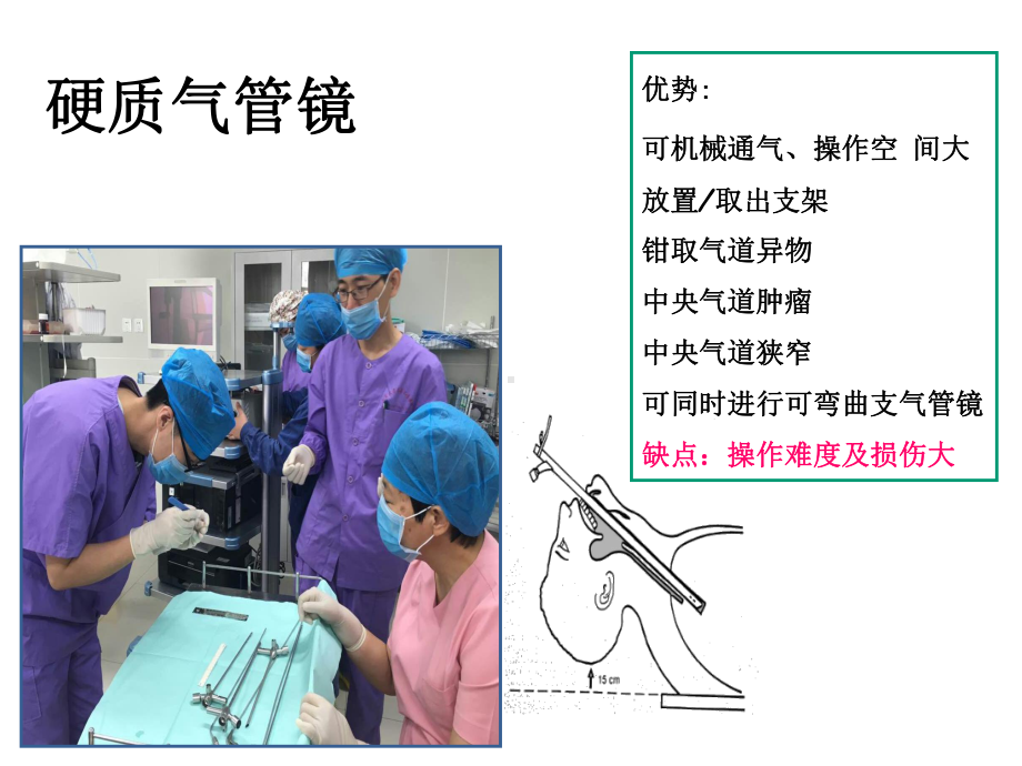 支气管镜基本知识培训课件(44张).ppt_第3页