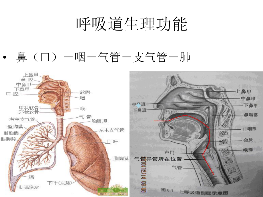 气管切开护理[方案]课件.ppt_第3页