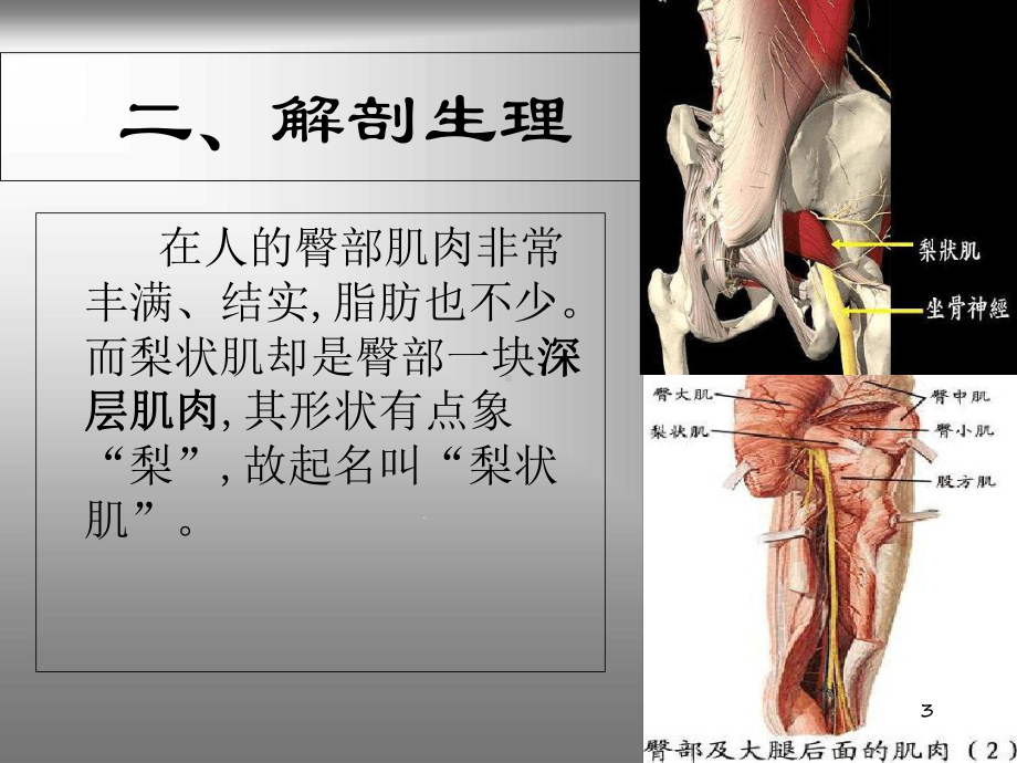 梨状肌综合征课件-2.ppt_第3页