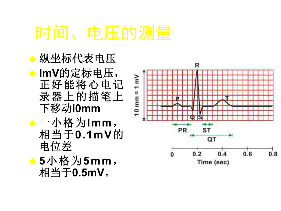 心电图测量基础知识精选课件.ppt_第3页