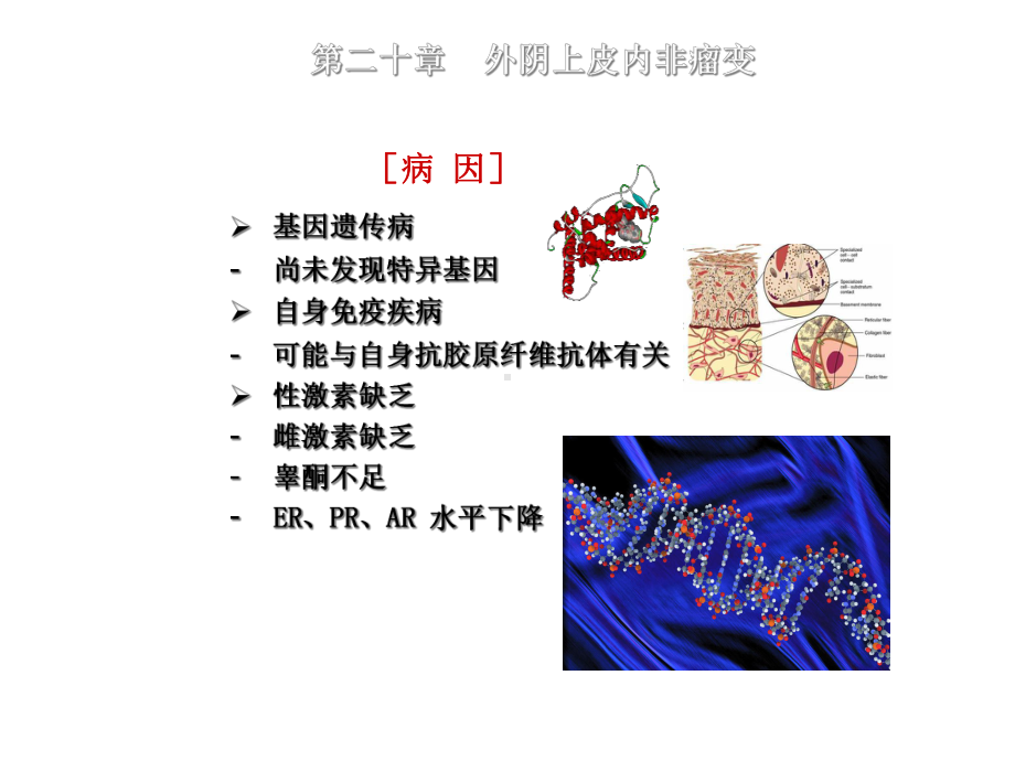 外阴上皮内非瘤变课件.ppt_第3页