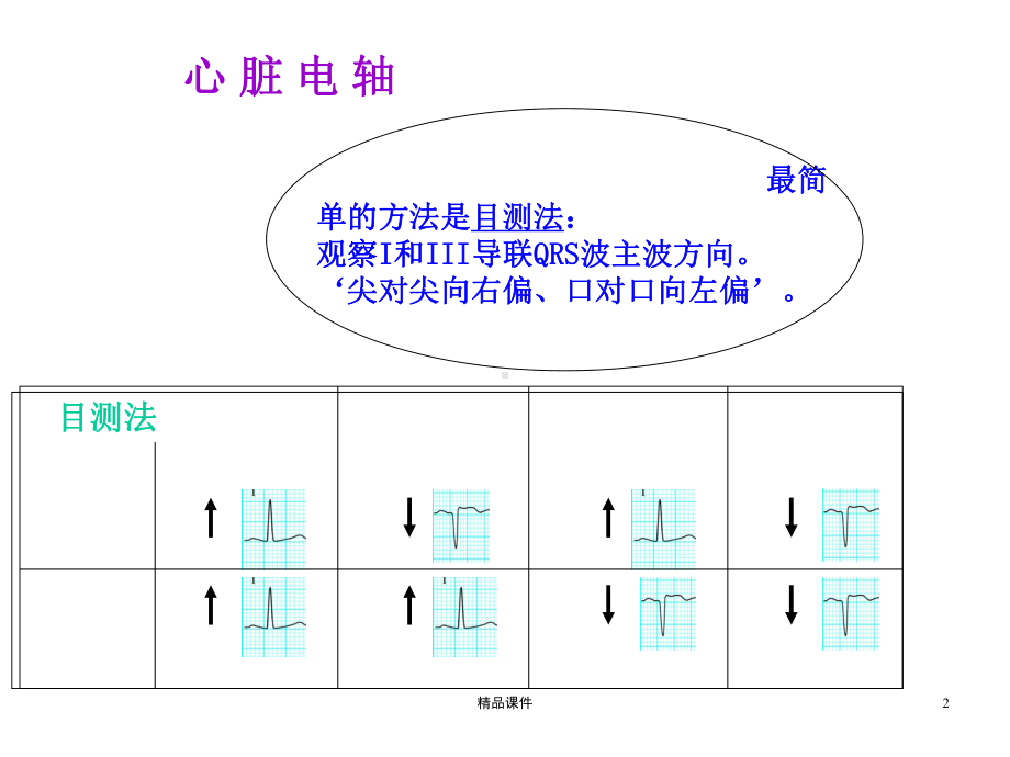 常见异常心电图医学课件.ppt_第2页